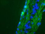 CD56 Antibody in Immunohistochemistry (Frozen) (IHC (F))