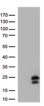 IL29 (IFNL1) Antibody in Western Blot (WB)