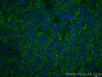 IL-9 Antibody in Immunohistochemistry (Paraffin) (IHC (P))