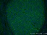 IL-9 Antibody in Immunohistochemistry (Paraffin) (IHC (P))