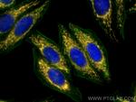 ATP5A1 Antibody in Immunocytochemistry (ICC/IF)