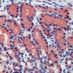 Caspase 8 Antibody in Immunohistochemistry (IHC)