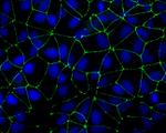 Rabbit IgG (H+L) Highly Cross-Adsorbed Secondary Antibody in Immunocytochemistry (ICC/IF)