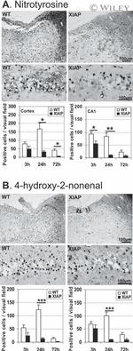 Nitrotyrosine Antibody in Immunohistochemistry (Paraffin) (IHC (P))