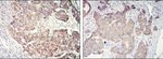 ErbB2 (HER-2) Antibody in Immunohistochemistry (Paraffin) (IHC (P))