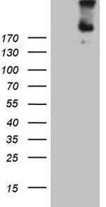 FLT4 Antibody in Western Blot (WB)