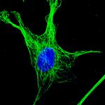 Mouse IgG (H+L) Highly Cross-Adsorbed Secondary Antibody in Immunocytochemistry (ICC/IF)