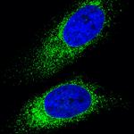 Mouse IgG (H+L) Highly Cross-Adsorbed Secondary Antibody in Immunocytochemistry (ICC/IF)