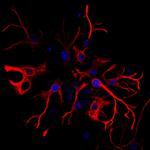 Mouse IgG (H+L) Highly Cross-Adsorbed Secondary Antibody in Immunocytochemistry (ICC/IF)