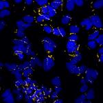 Rabbit IgG (H+L) Highly Cross-Adsorbed Secondary Antibody in Immunocytochemistry (ICC/IF)