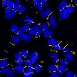 Rabbit IgG (H+L) Highly Cross-Adsorbed Secondary Antibody in Immunocytochemistry (ICC/IF)