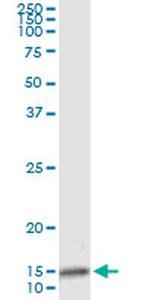 IL8 Antibody in Immunoprecipitation (IP)