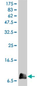 IL8 Antibody in Western Blot (WB)