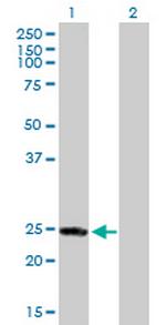 RAB4A Antibody in Western Blot (WB)