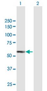 IRAK4 Antibody in Western Blot (WB)