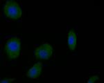 Dopamine Transporter Antibody in Immunocytochemistry (ICC/IF)