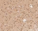 Dopamine Transporter Antibody in Immunohistochemistry (Paraffin) (IHC (P))