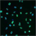 Lamin A/C Antibody in Immunocytochemistry (ICC/IF)