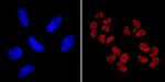 SOX2 Antibody in Immunocytochemistry (ICC/IF)