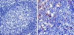 Nestin Antibody in Immunohistochemistry (IHC)