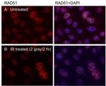 RAD51 Antibody in Immunocytochemistry (ICC/IF)