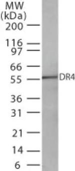 DR4 Antibody in Western Blot (WB)