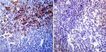 HIF1A Antibody in Immunohistochemistry (Paraffin) (IHC (P))