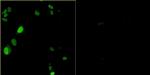 Bovine Papilloma Virus Type 1 E2 Antibody in Immunocytochemistry (ICC/IF)