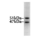 GSK3B Antibody in Western Blot (WB)