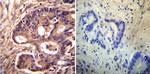 alpha Actinin 4 Antibody in Immunohistochemistry (Paraffin) (IHC (P))