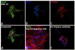 CD56 Antibody