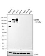 CD56 Antibody in Western Blot (WB)