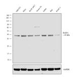 RAD51 Antibody in Western Blot (WB)