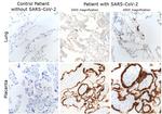 SARS/SARS-CoV-2 Nucleocapsid Antibody in Immunohistochemistry (IHC)