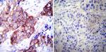 HSP27 Antibody in Immunohistochemistry (Paraffin) (IHC (P))