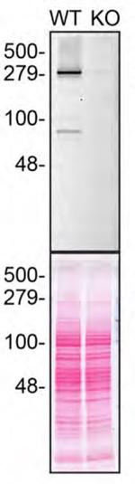 Huntingtin Antibody in Western Blot (WB)