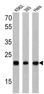 RAB9 Antibody in Western Blot (WB)