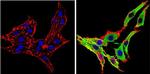 alpha Synuclein Antibody in Immunocytochemistry (ICC/IF)