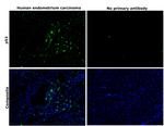 p53 Antibody in Immunohistochemistry (Paraffin) (IHC (P))