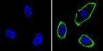 EGFR Antibody in Immunocytochemistry (ICC/IF)