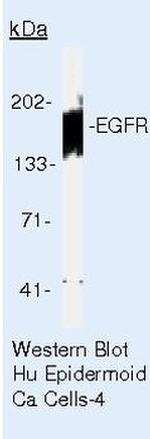 EGFR Antibody in Western Blot (WB)