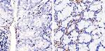 Cyclin D1 Antibody in Immunohistochemistry (Paraffin) (IHC (P))