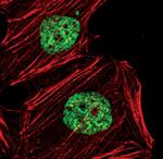 H3K36me2 Antibody in Immunocytochemistry (ICC/IF)