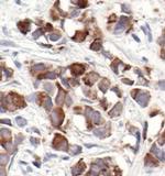 MUC1 Antibody in Immunohistochemistry (Paraffin) (IHC (P))