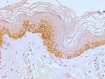 TLR4 Antibody in Immunohistochemistry (Paraffin) (IHC (P))