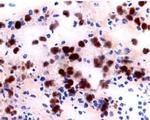 CD122 Antibody in Immunohistochemistry (Frozen) (IHC (F))