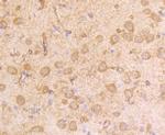 IFNAR1 Antibody in Immunohistochemistry (Paraffin) (IHC (P))