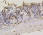 ASH2L Antibody in Immunohistochemistry (Paraffin) (IHC (P))