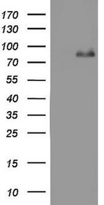 ACE2 Antibody in Western Blot (WB)