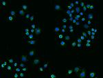 TREM2 Antibody in Immunocytochemistry (ICC/IF)